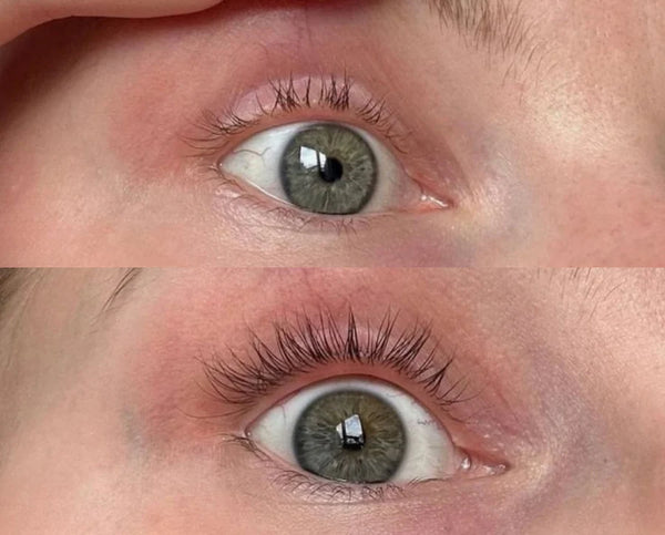 Mi antes y despues ahora super contenta